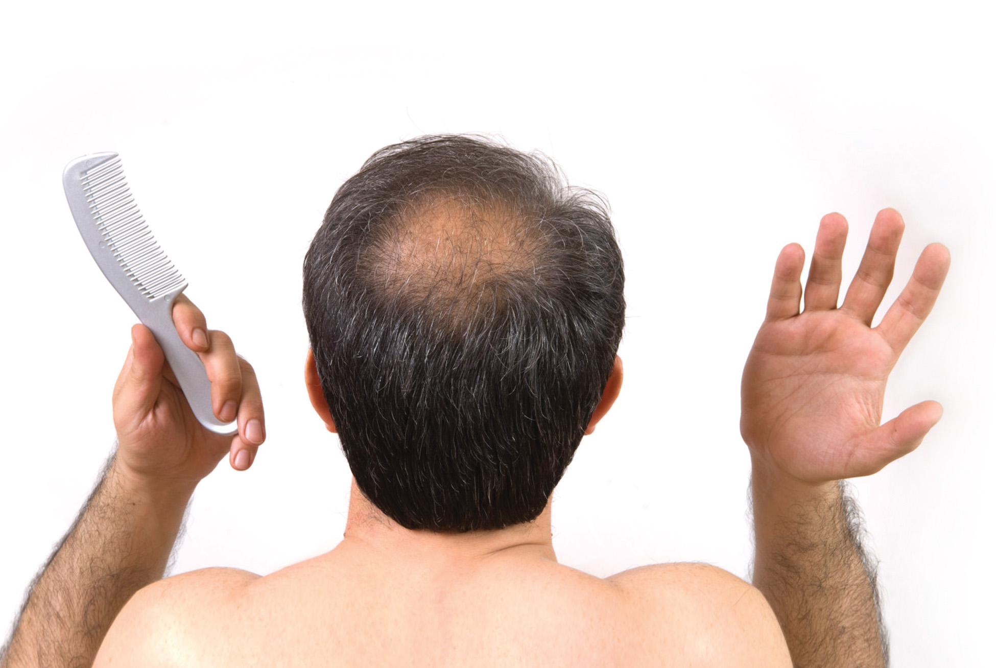 thuốc chống rụng tóc làm yếu sinh lý đàn ông