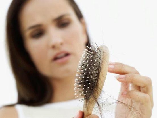 Tóc rụng trên 100 sợi mỗi ngày là dấu hiệu bệnh rụng tóc