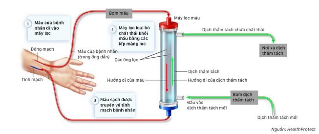 Quy trình chạy thận nhân tạo